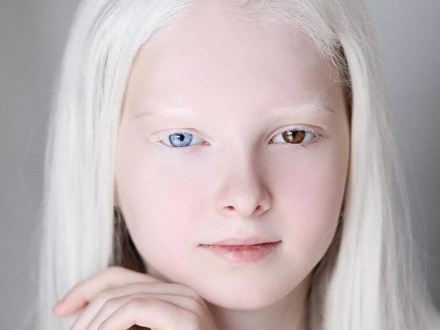 アルビノとオッドアイを持つ11歳のチェチェン人美少女が神秘的だと話題に